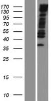 MYPN Protein (Over-Expression Lysate Myc-DDK (Flag))