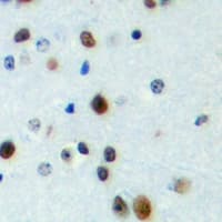 Polyclonal Rabbit anti-Human FOXN4 Antibody (C-Terminus, IHC, WB)