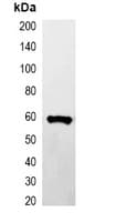 GST Tag Antibody