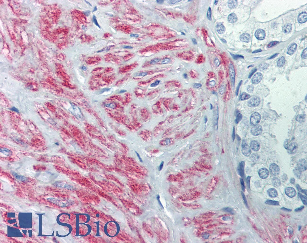 IHC-plus™ SLC39A10 / ZIP10 Antibody