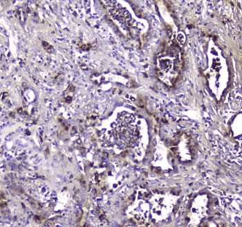 Polyclonal Rabbit anti-Human MAC-2-BP / LGALS3BP Antibody (IHC, WB)