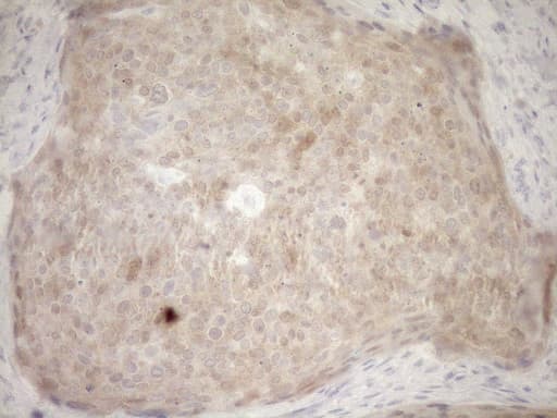 Monoclonal Mouse anti-Human p16INK4a / CDKN2A Antibody (clone OTI8C9, IHC, WB)