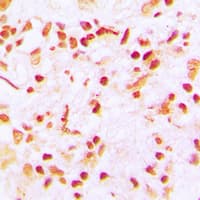 Polyclonal Rabbit anti-Human CENPA / CENP-A Antibody (N-Terminus, IHC, WB)