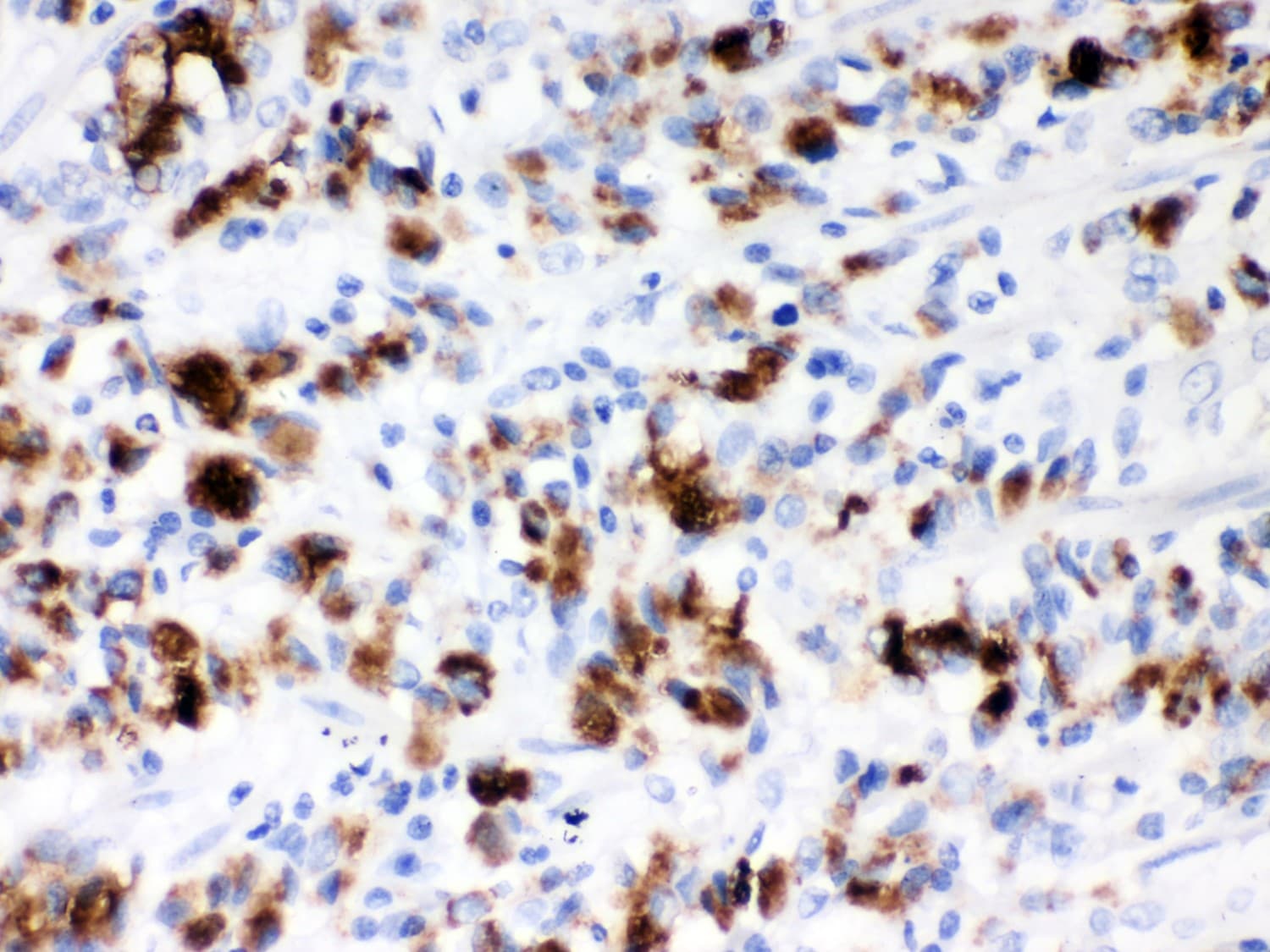 MUC5AC Antibody (aa4848-5030)