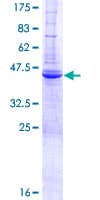 Human ZBP1 Protein (Recombinant GST)