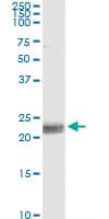 Monoclonal Mouse anti-Human CD8A / CD8 Alpha Antibody (clone 4B9)