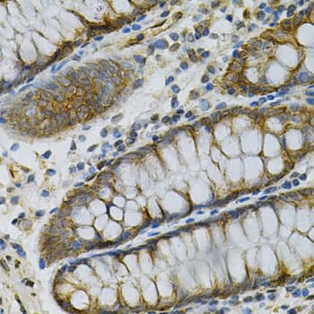 AK1 / Adenylate Kinase 1 Antibody
