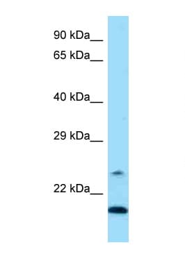 Polyclonal Rabbit anti-Mouse WDFY1 Antibody (aa42-91, IHC, WB)