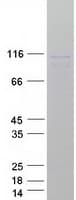 Human LIG3 / DNA Ligase III Protein (Recombinant Myc-DDK (Flag))