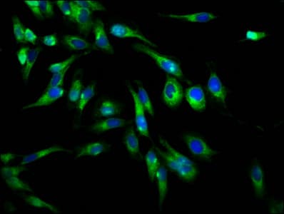 PLXNB1 / Plexin-B1 Antibody