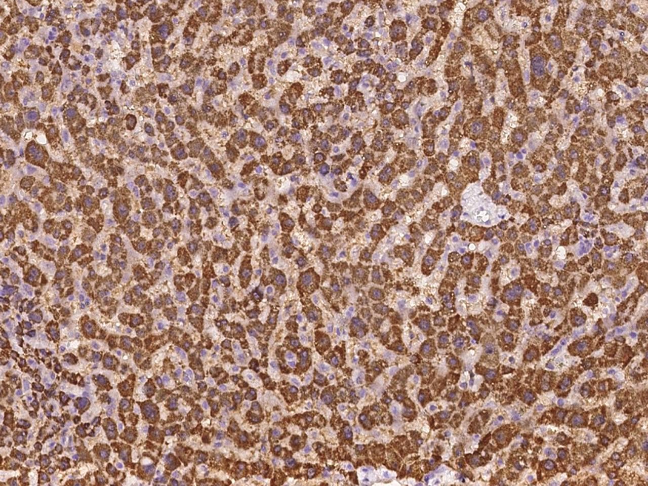 ABCB9 Antibody