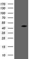 ERCC1 Antibody (clone OTI1A1)