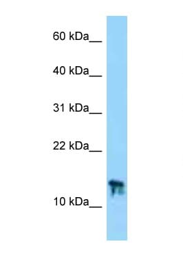 C9orf25 Antibody (aa49-98)