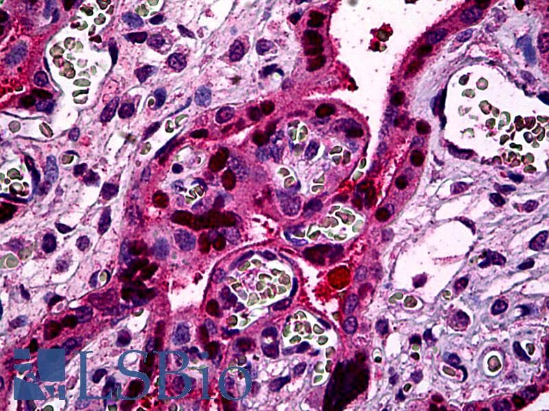 IHC-plus™ STAT5B Antibody (clone 5D6)