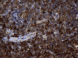 NME1 / NM23 Antibody (clone OTI2H10)