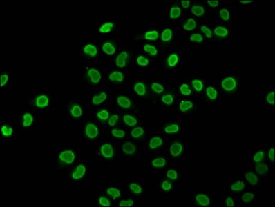 HIST1H4I Antibody
