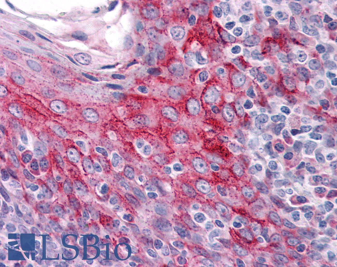 IHC-plus™ ZMYM4 / ZNF262 Antibody