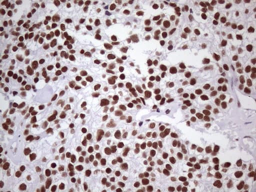 Monoclonal Mouse anti-Human NUDT21 Antibody (clone OTI1B1, Carrier-free, aa2-227, IHC, IF, WB)
