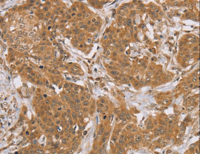KCNJ15 / KIR4.2 Antibody