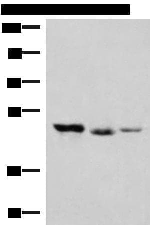 HMBOX1 Antibody