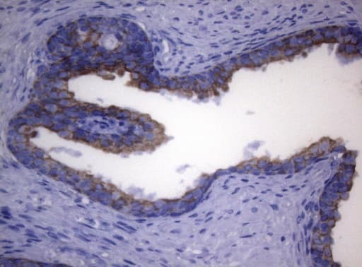 SYNC / SYNCOILIN Antibody (clone OTI5B8)