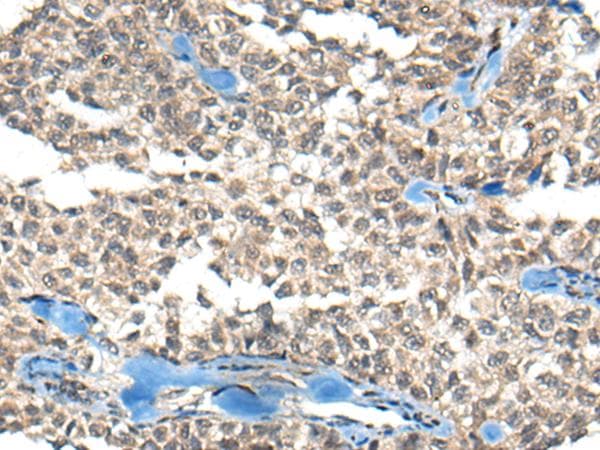 NRSF / REST Antibody