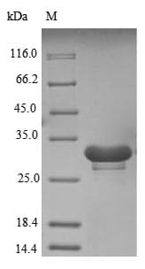 Human SNRP70 / SNRNP70 Protein (Recombinant 6His, N-terminus)