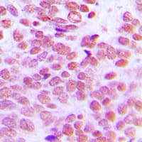 SSB / La Antibody (C-Terminus)