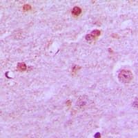 N4BP1 Antibody (Internal)