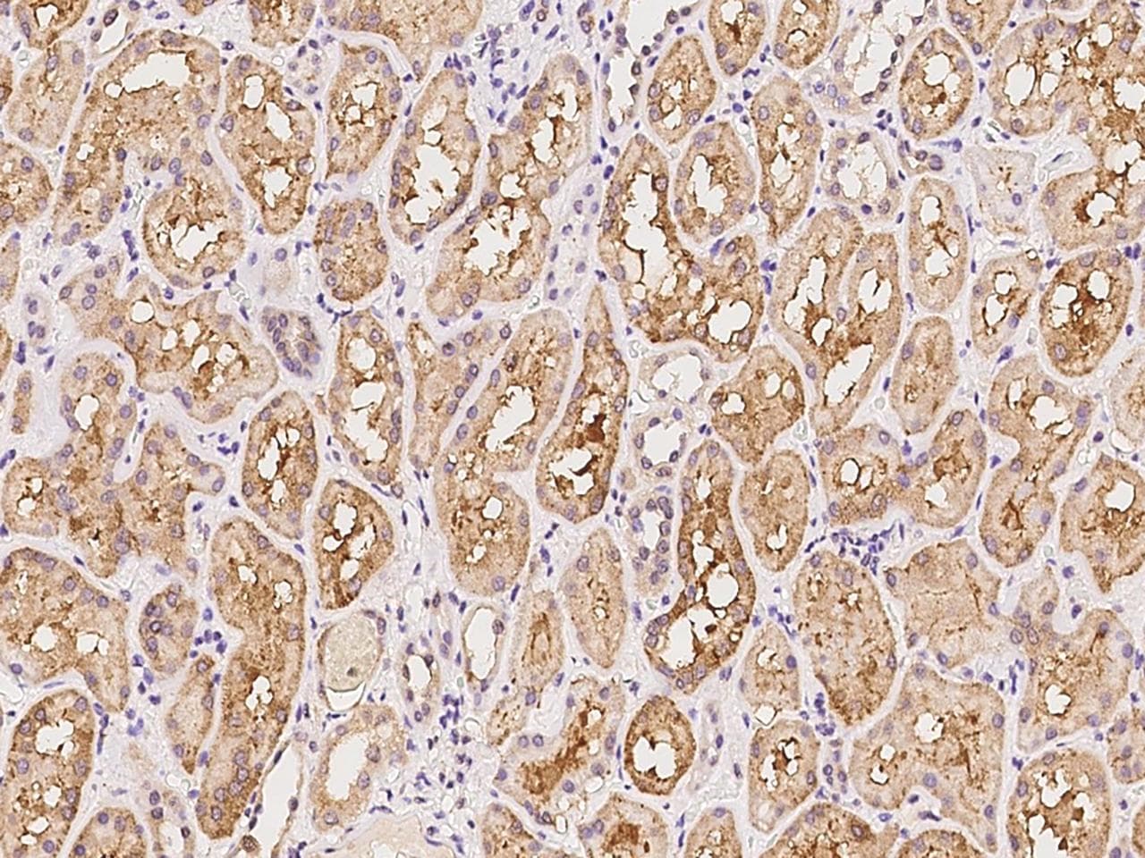 SHISA5 / SCOTIN Antibody