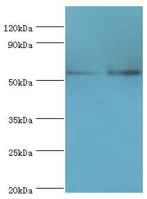 PRKAG3 / AMPK Gamma 3 Antibody (aa1-210)