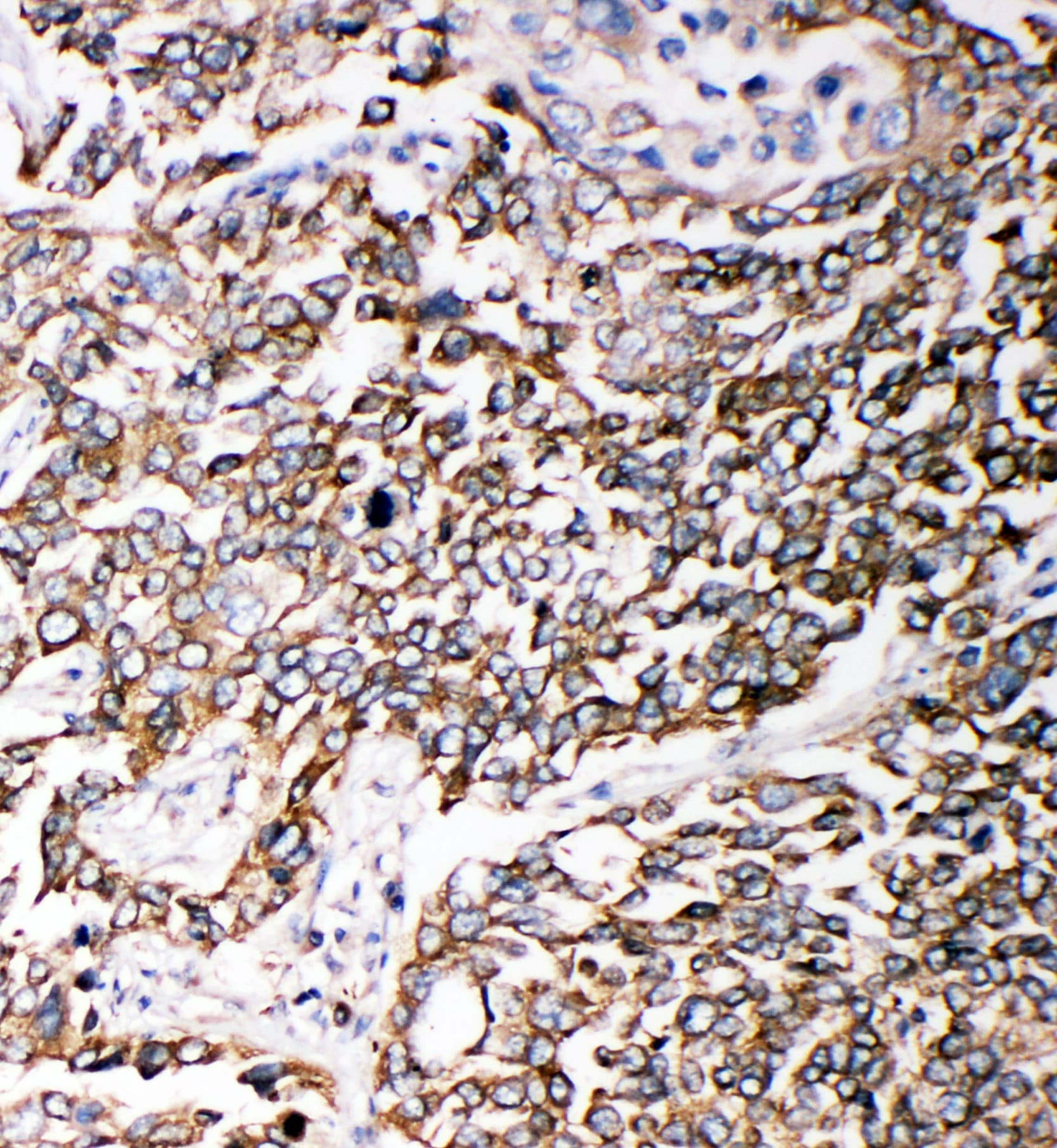 PMP70 Antibody (aa646-659)