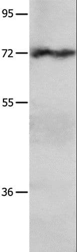 CRD-BP / ZBP1 / IGF2BP1 Antibody