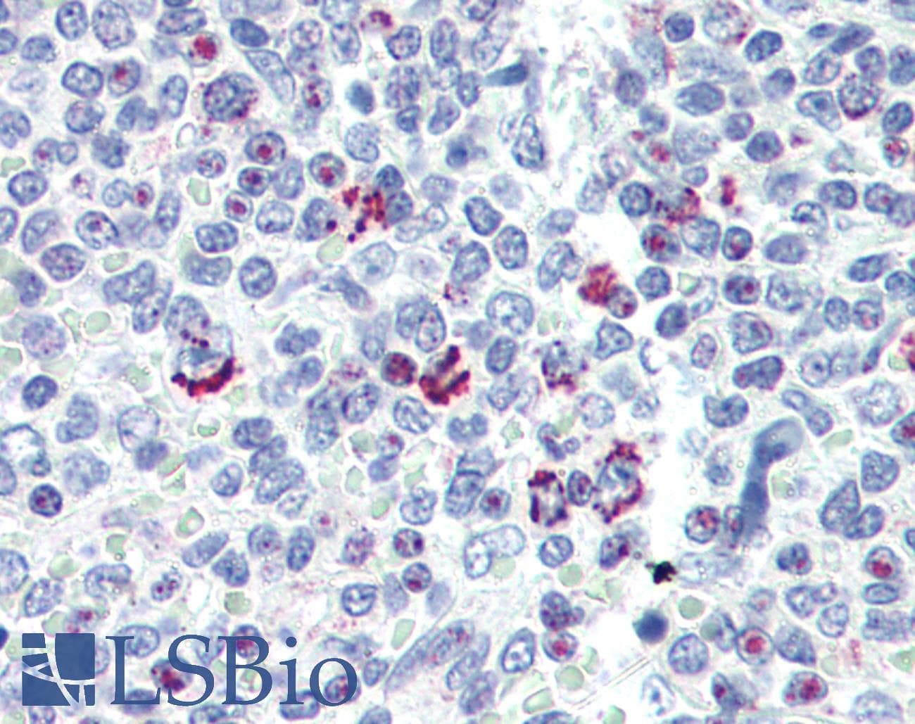 IHC-plus™ Polyclonal Rabbit anti-Human LIN28B Antibody (aa1-30, IHC, IF, WB)
