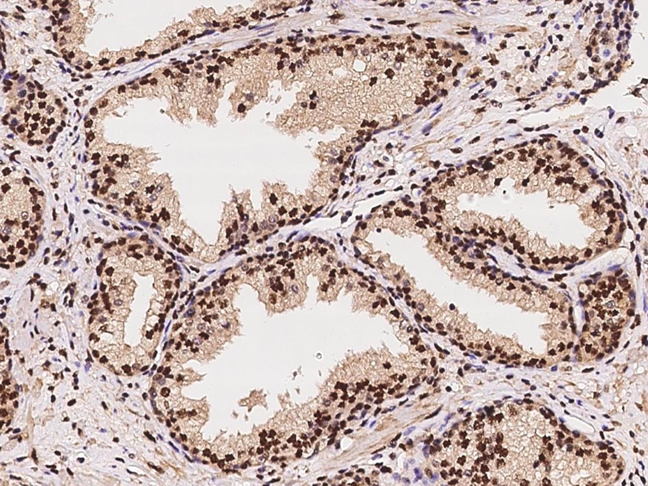 TP53BP1 / 53BP1 Antibody