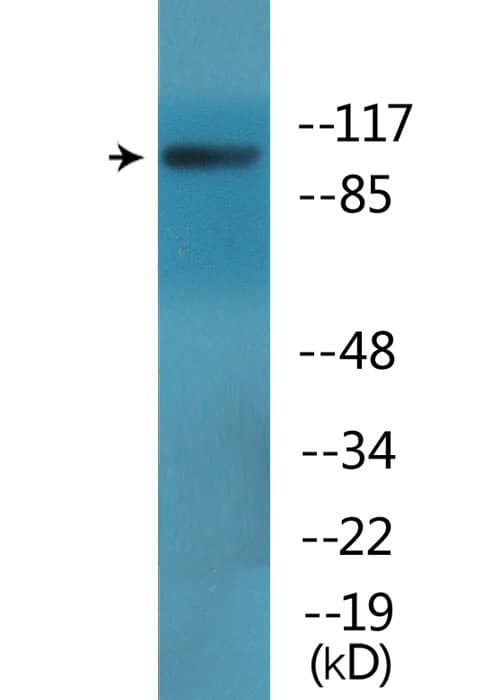 Band 4.1 / EPB41 Antibody (phospho-Tyr418/Tyr660)