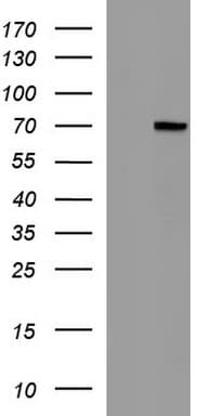 ALB / Serum Albumin Antibody (aa19-609, clone OTI3B10)