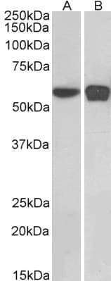 IHC-plus™ PLRG1 Antibody (aa501-514)