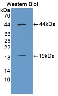 MKI67 / Ki67 Antibody (aa2386-2674, APC)