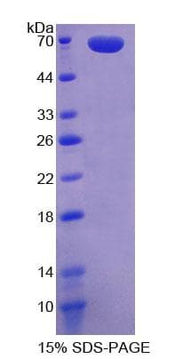 Human WNT2B Protein (Recombinant His-GST)