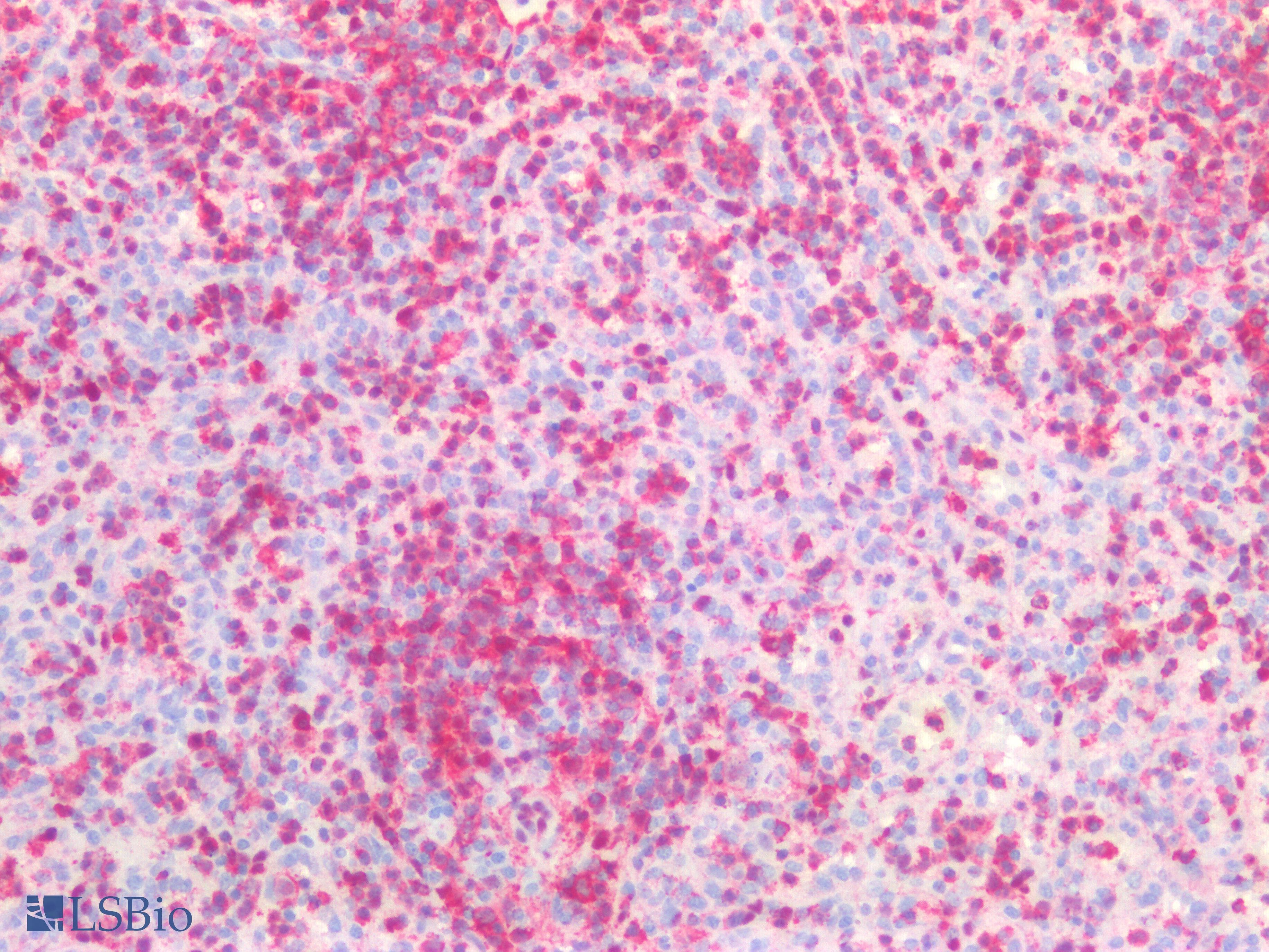 IHC-plus™ Polyclonal Rabbit anti-Human ANXA1 / Annexin A1 Antibody (Internal, IHC, IF, WB)