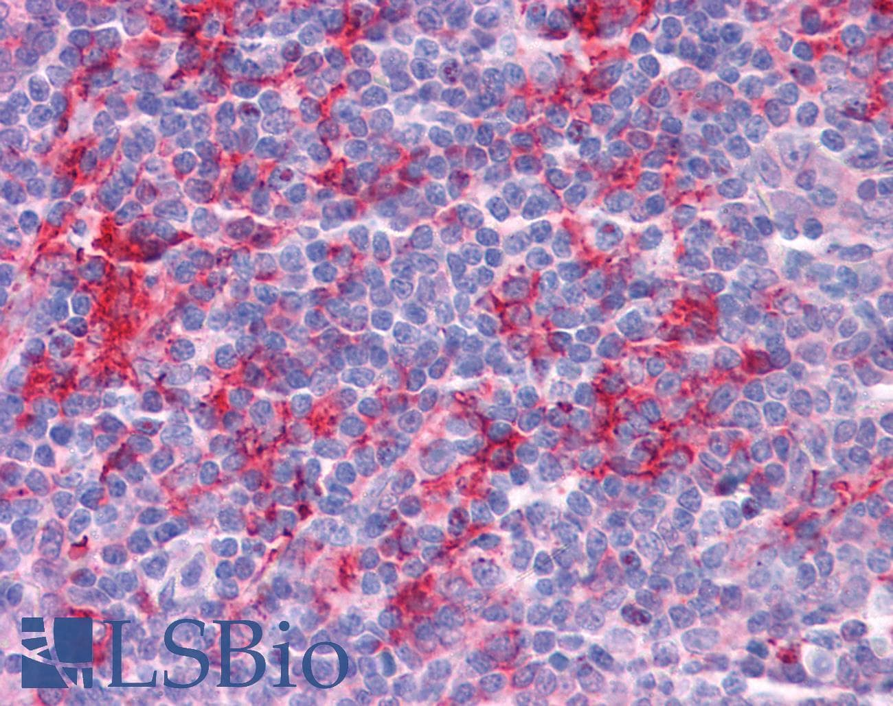 IHC-plus™ Polyclonal Chicken anti-Human KLHL25 Antibody (IHC, IF, WB)