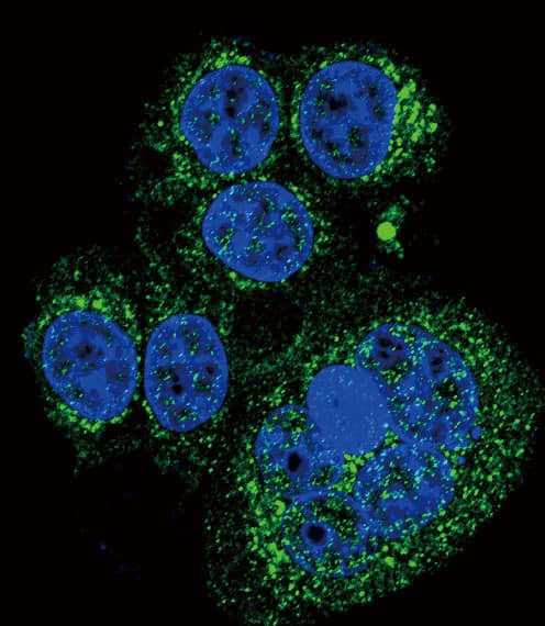 HTRA1 Antibody (aa116-147)