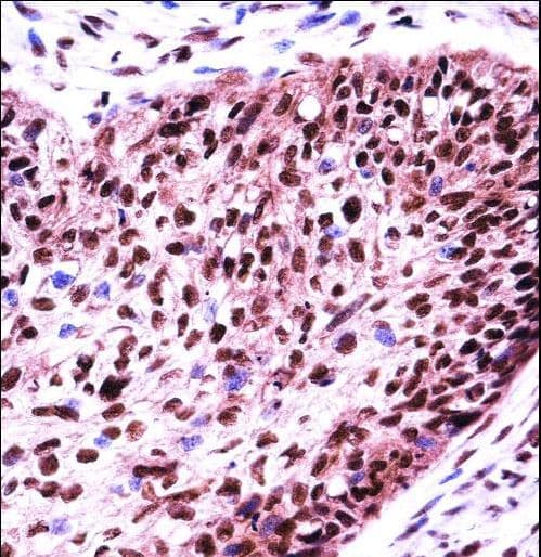 Polyclonal Rabbit anti-Human SF3B1 Antibody (aa374-402, IHC, WB)