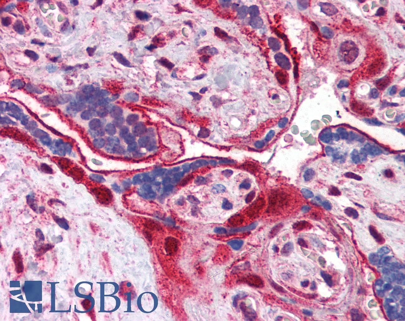 IHC-plus™ ANXA11 / Annexin XI Antibody (aa8-20)