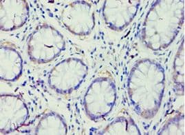 Polyclonal Rabbit anti-Human ARHGAP26 / GRAF Antibody (aa625-814, IHC)