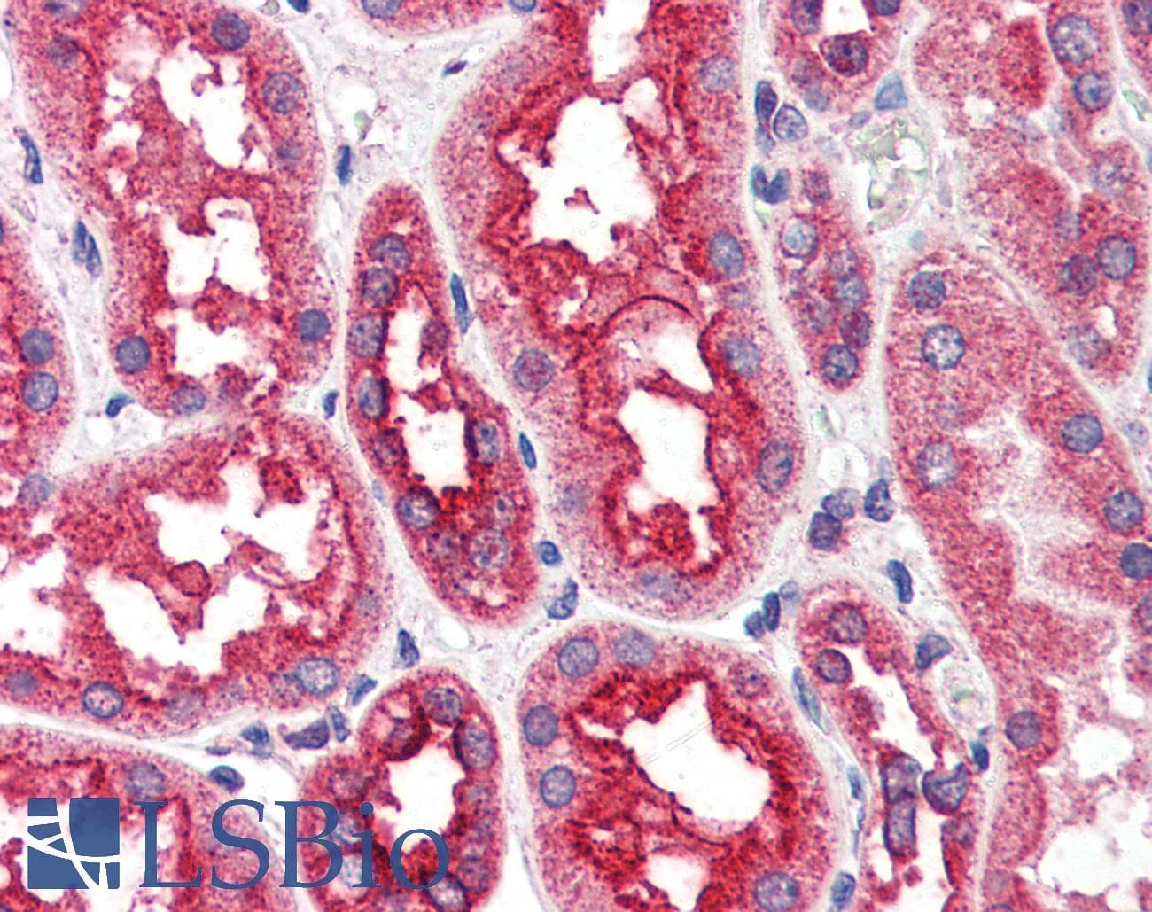 IHC-plus™ Polyclonal Goat anti-Human CPT1A Antibody (aa621-634, IHC, WB)