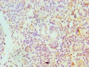 Polyclonal Rabbit anti-Human SERPINA4 / Kallistatin Antibody (aa178-427, IHC)