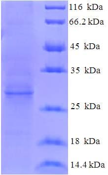Hepatitis E Virus HEV ORF3 Protein (Recombinant His-SUMO)