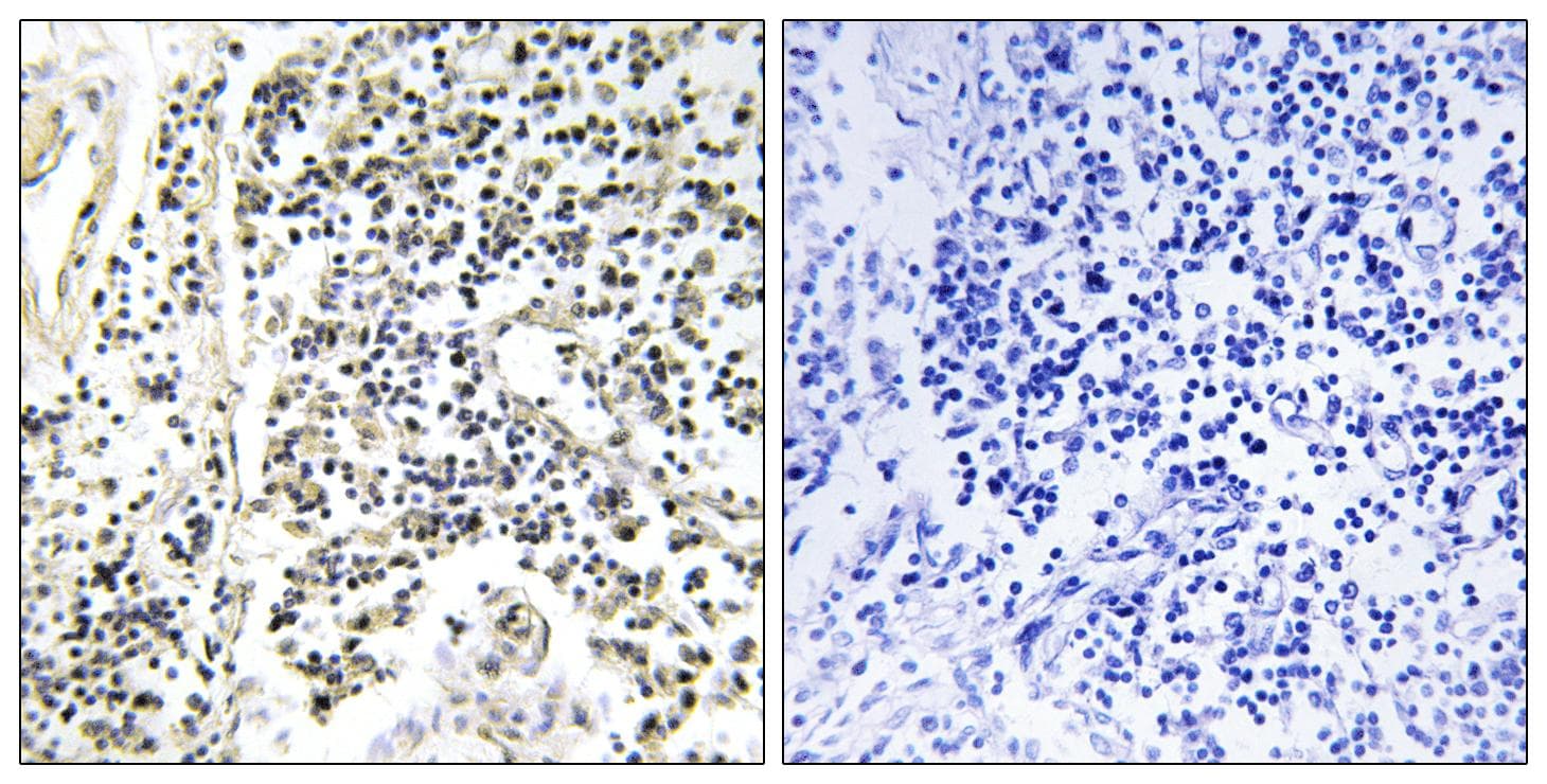 NFKBIA / IKB Alpha / IKBA Antibody (phospho-Tyr305)